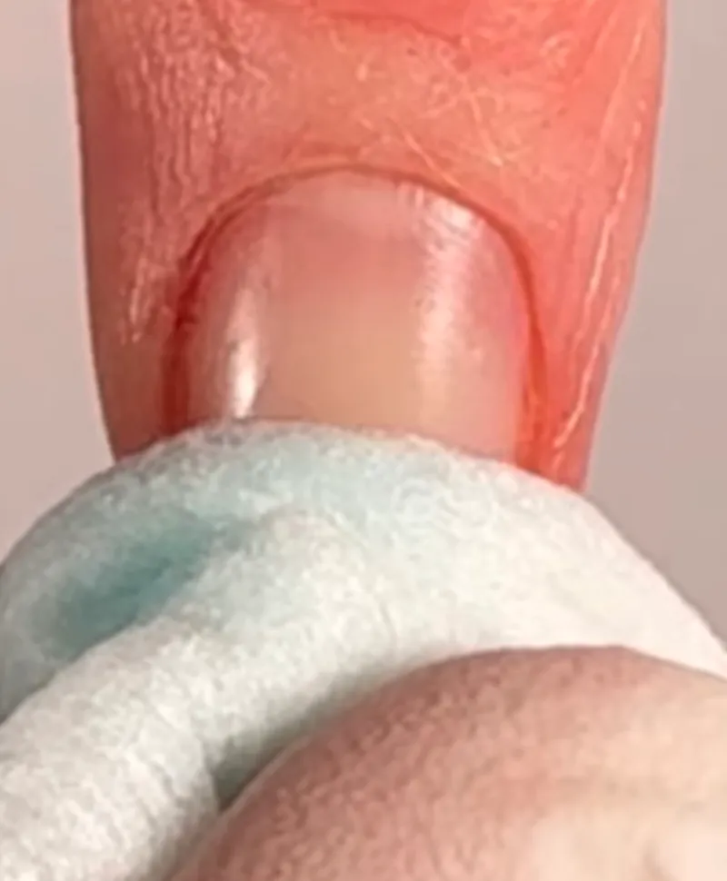 Dépose vernis semi-permanent SHELLAC™ renforcé (gainage) - Détail 2